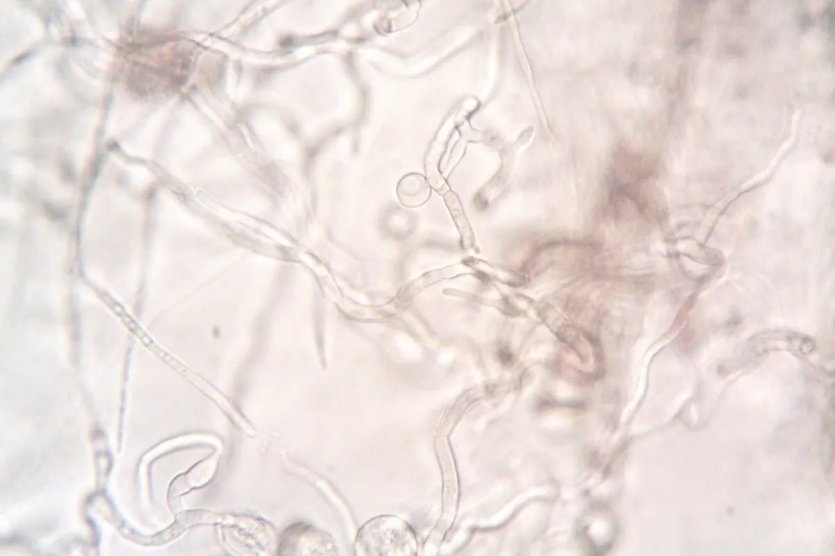 Qué es la biopelícula, por qué representa un riesgo sanitario en torres de enfriamiento y cómo implementar un programa efectivo de control con biocidas y limpieza mecánica.